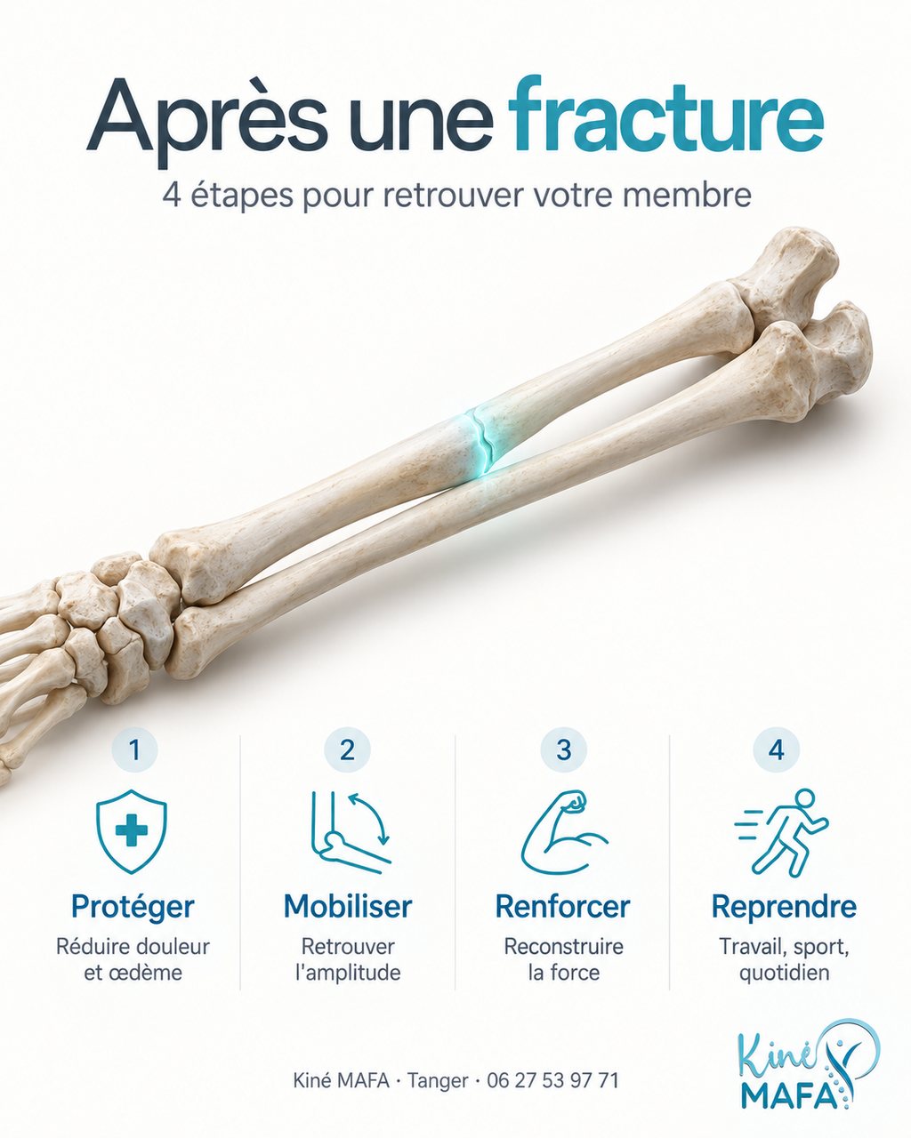 Infographie : les 4 étapes après une fracture